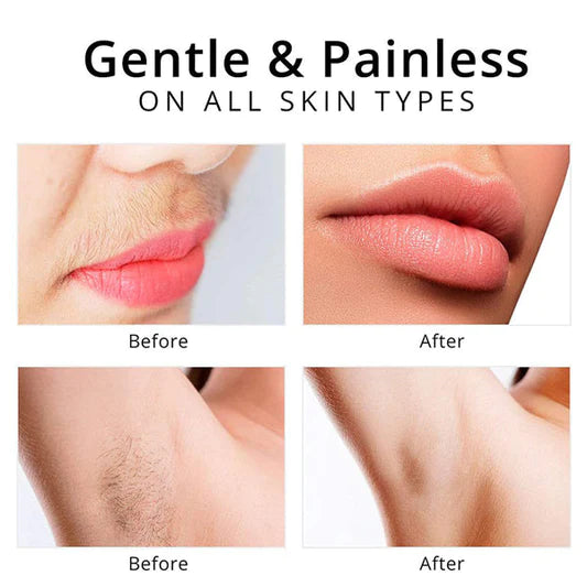 2 In 1 USB Charging Mini Facial Painless Hair Remover - Light Pink - Shop N Save