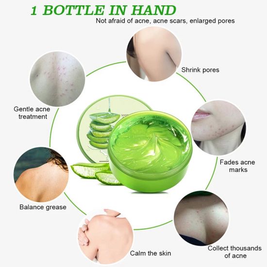 Aloe Vera Soothing Moisturizer Deep Hydration Skin Repairing Gel Remove Acne 300g Green