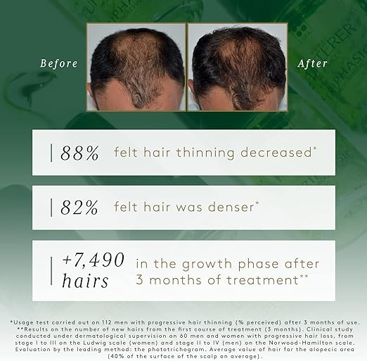 RF TRIPHASIC PROGRESSIVE ANTI HAIR LOSS TREATMENT 8X5.5 ML - Shop N Save