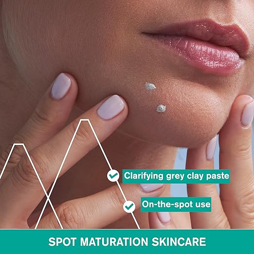 HYSEAC PATE SOS P 15G - Shop N Save