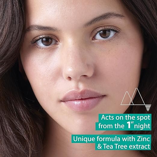 HYSEAC PATE SOS P 15G - Shop N Save