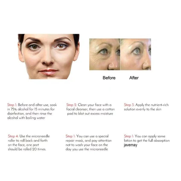 Derma Roller System For Face Massage - Black - Shop N Save