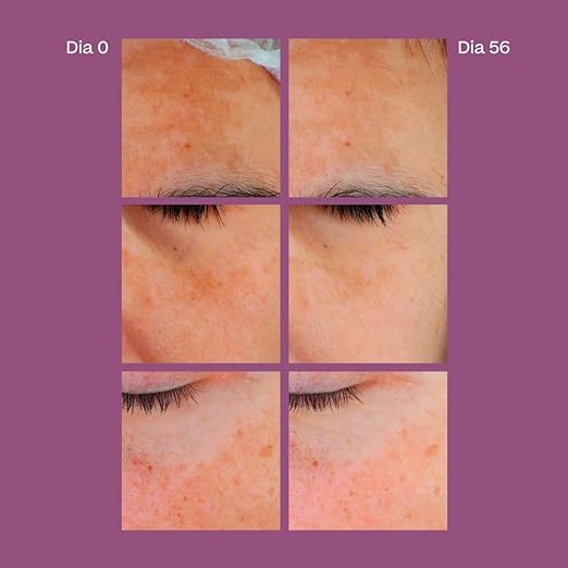 SSS SKIN DPIGMENT [SERUM ATX B3] 30 - Shop N Save