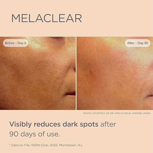 ISDIN CEUTICS MELACLEAR SERUM 15 ML - Shop N Save