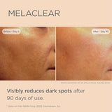 ISDIN CEUTICS MELACLEAR SERUM 15 ML - Shop N Save