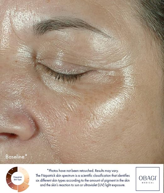 OBAGI MEDICAL ELASTIderm Eye Cream 15g - Shop N Save