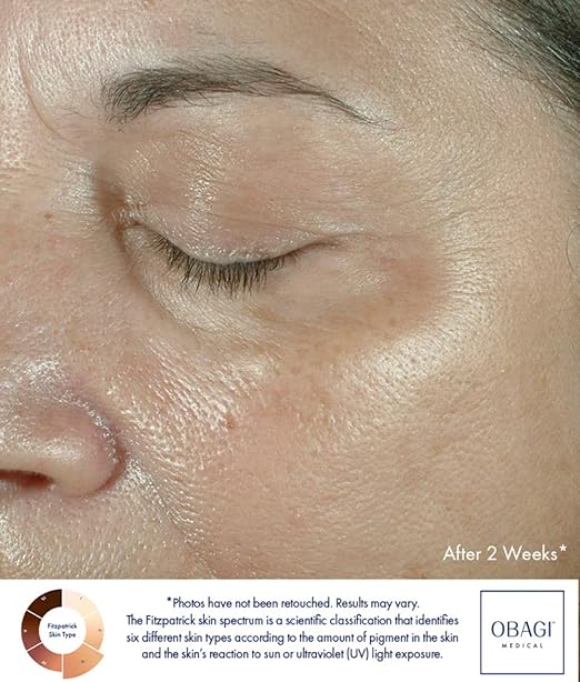 OBAGI MEDICAL ELASTIderm Eye Cream 15g - Shop N Save