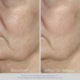 OBAGI ELASTIDERM FACIAL SERUM 1.0 OZ (30 ML) OBG-020-0 - Shop N Save